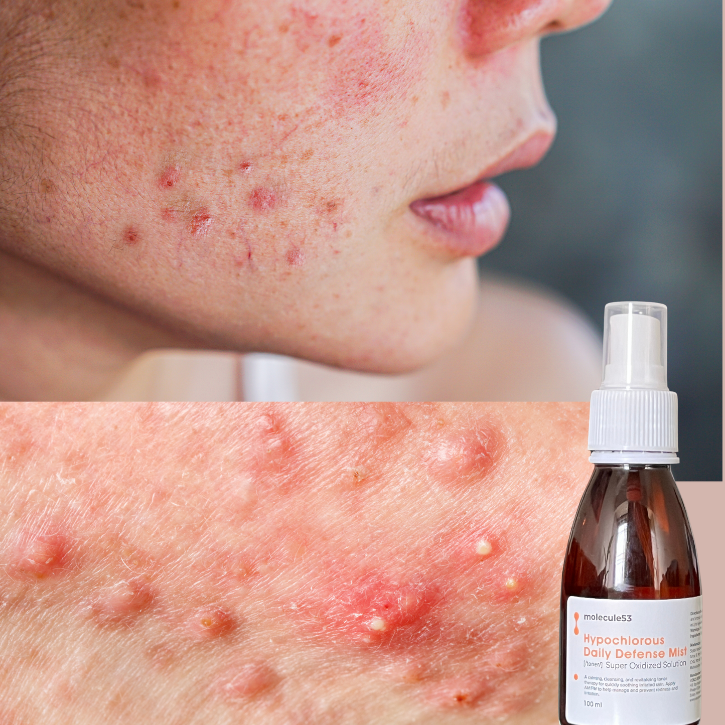 Hypochlorous Daily Defense Toner/Mist - SOS Spray