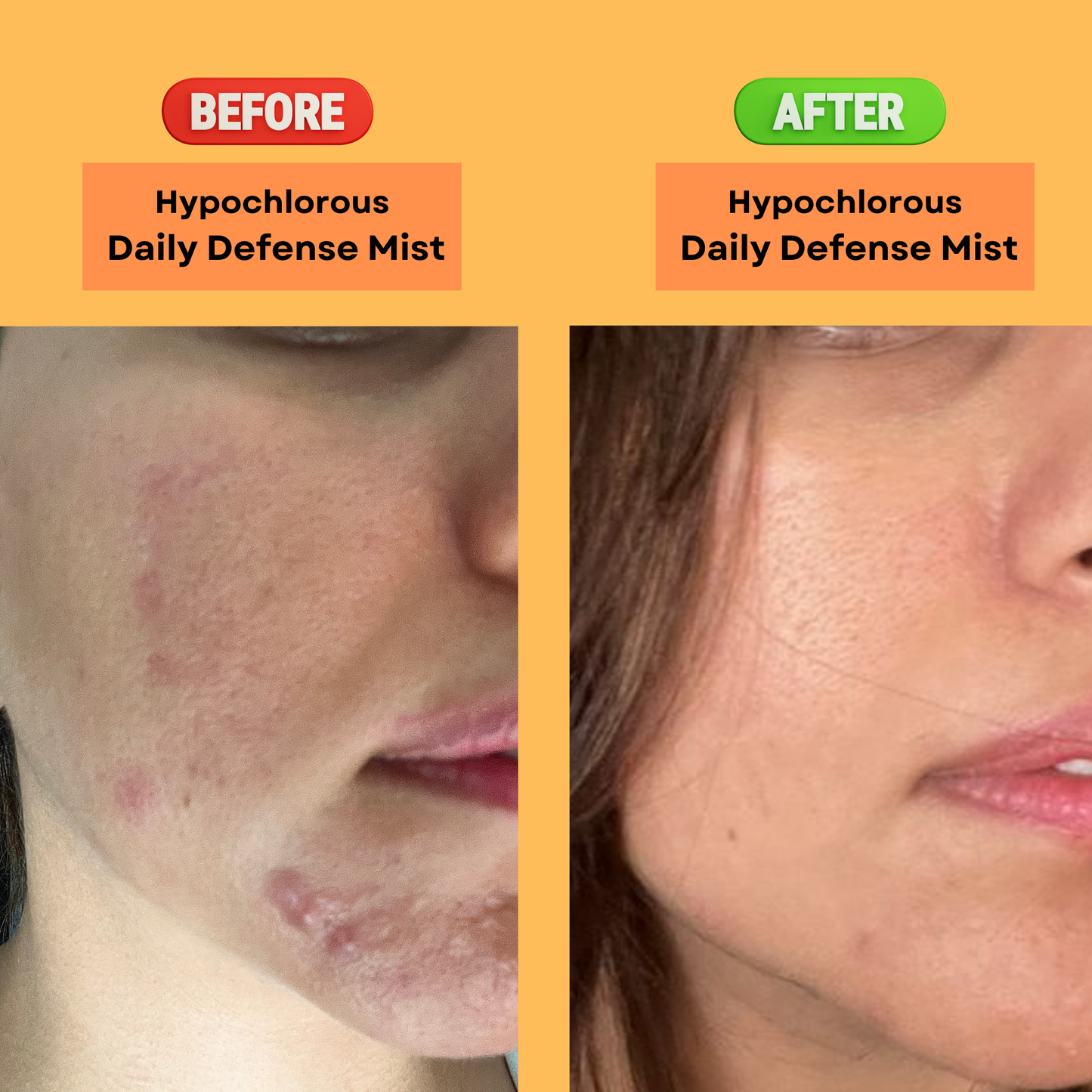 Hypochlorous Daily Defense Toner/Mist - SOS Spray