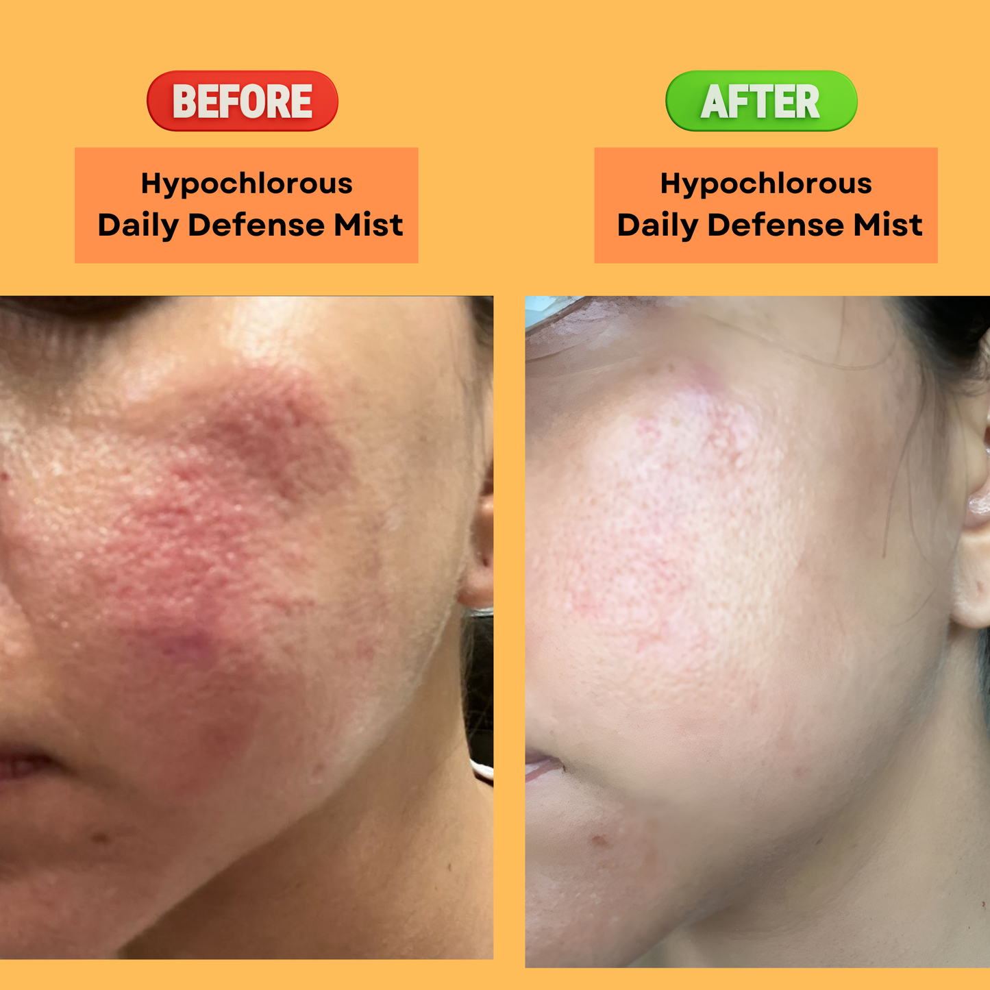 Hypochlorous Daily Defense Toner/Mist - SOS Spray