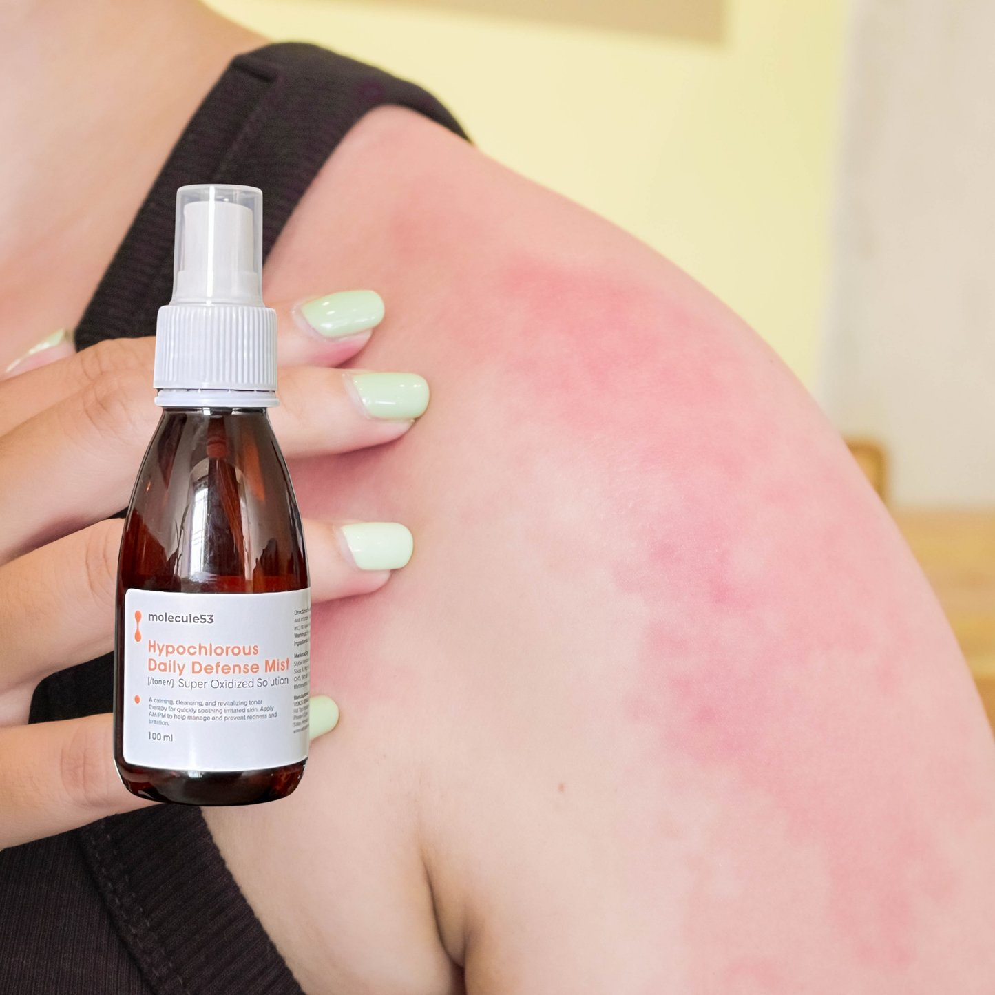 Hypochlorous Daily Defense Toner/Mist - SOS Spray